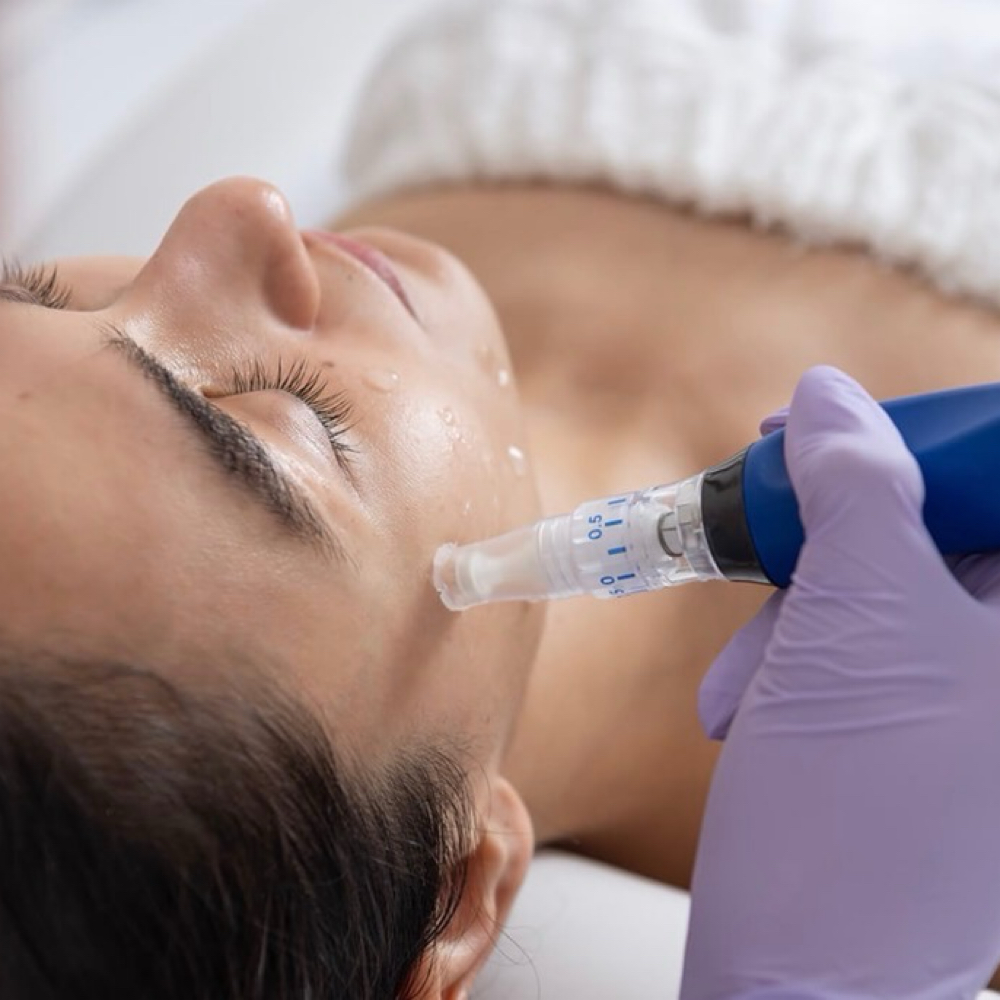 Microneedling at Poppy & Aster Beauty Bar in Columbia Falls, MT