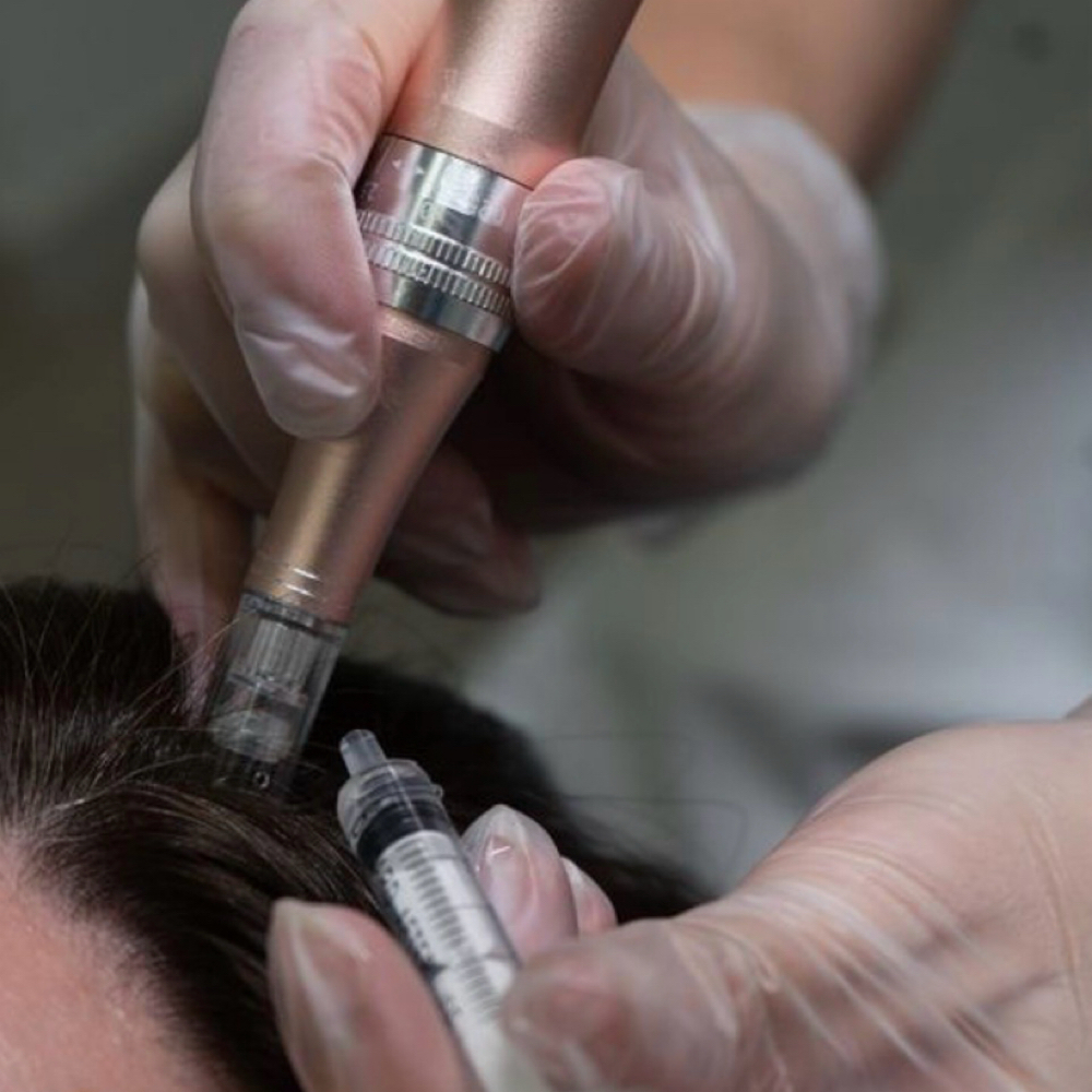 Follicle Activation Therapy at NKD SKN Headspa + Esthetics in Lees Summit, MO