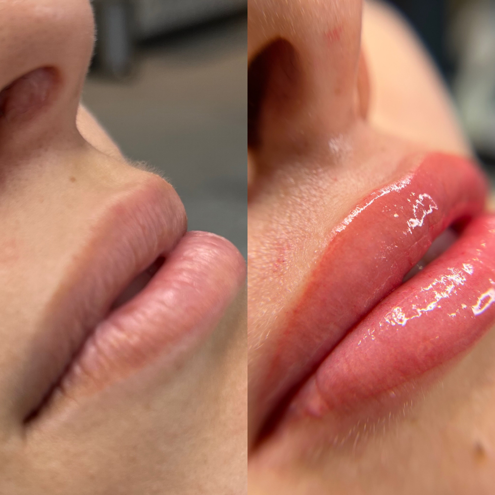 Lip Blush