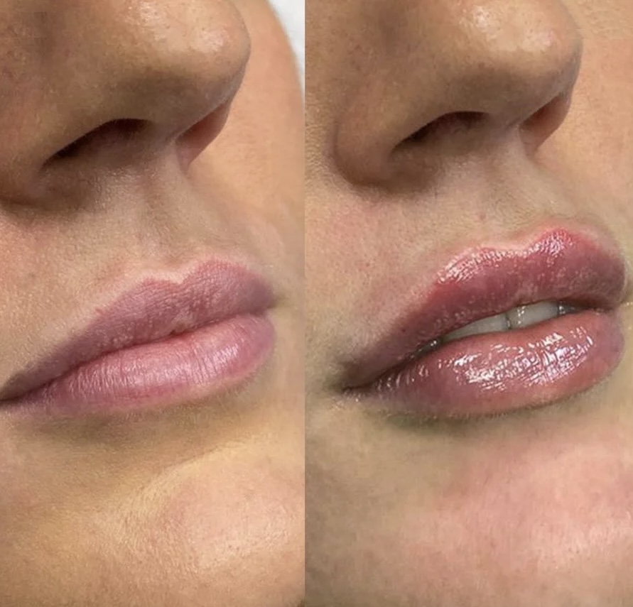 LIPS / HIDRATACION DE LABIOS