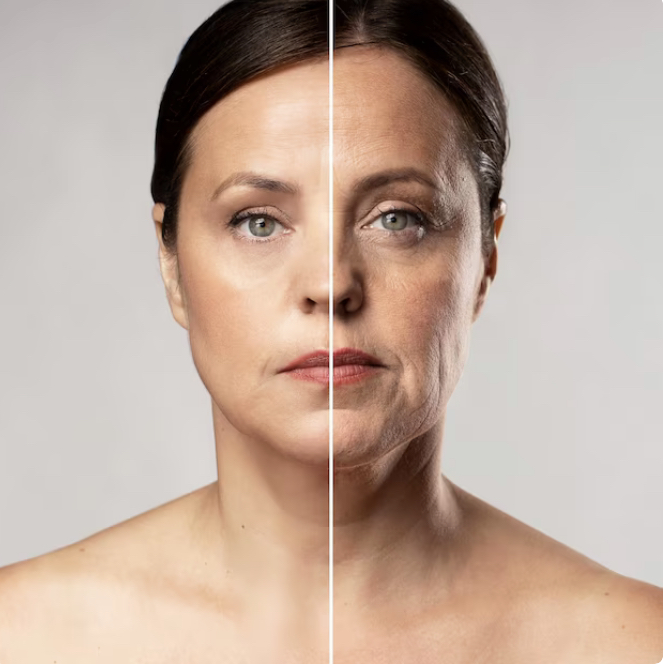 Lift & Resurface