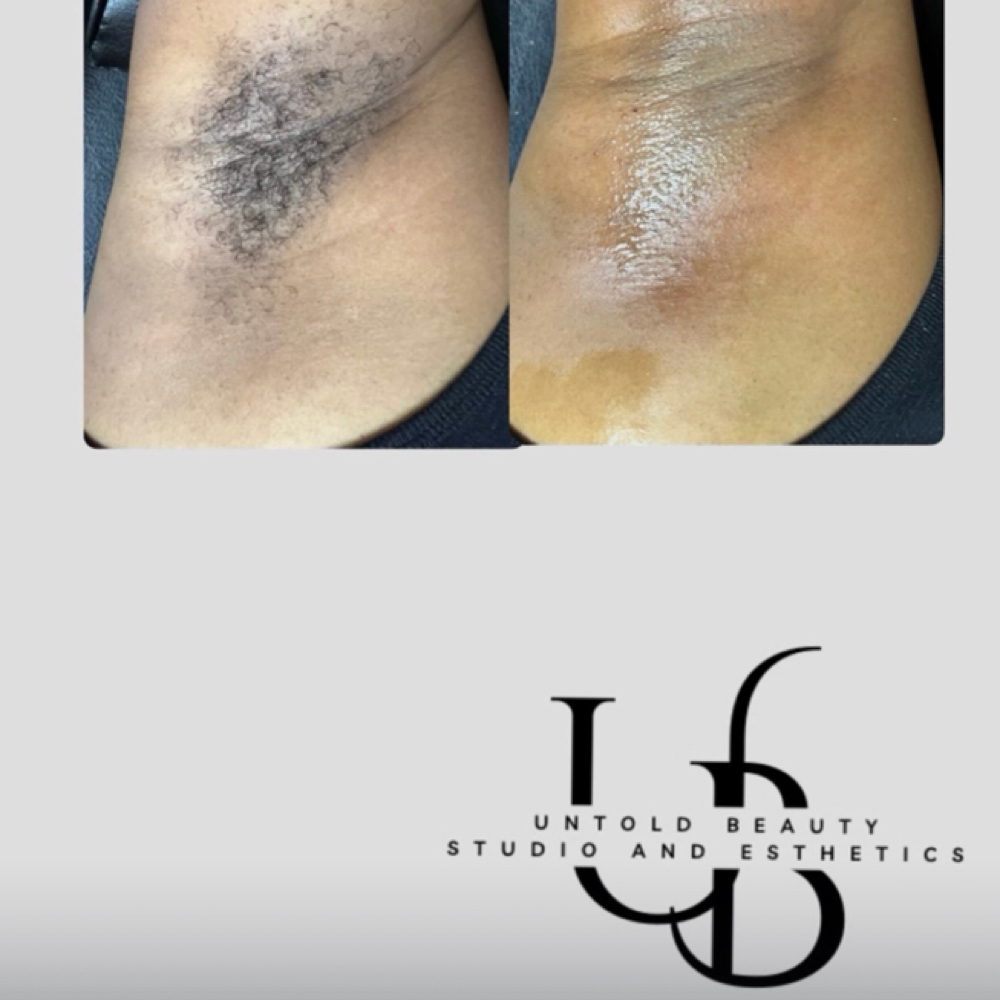 Underarm Wax at Untold Beauty Studio and Esthetics in Antioch, CA