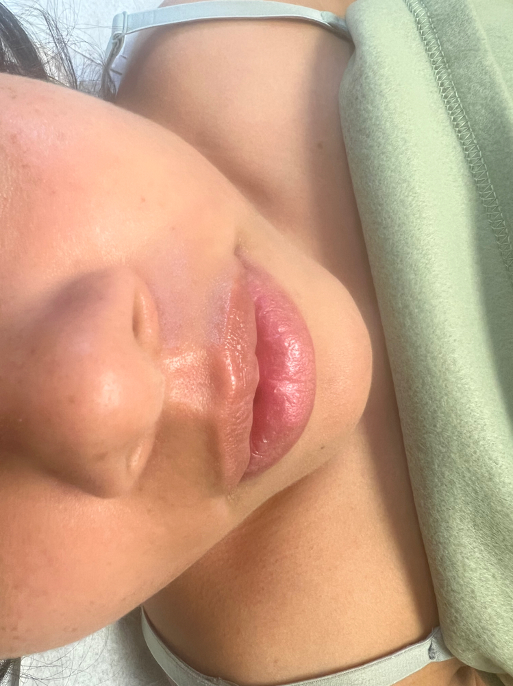 Full Chin Wax