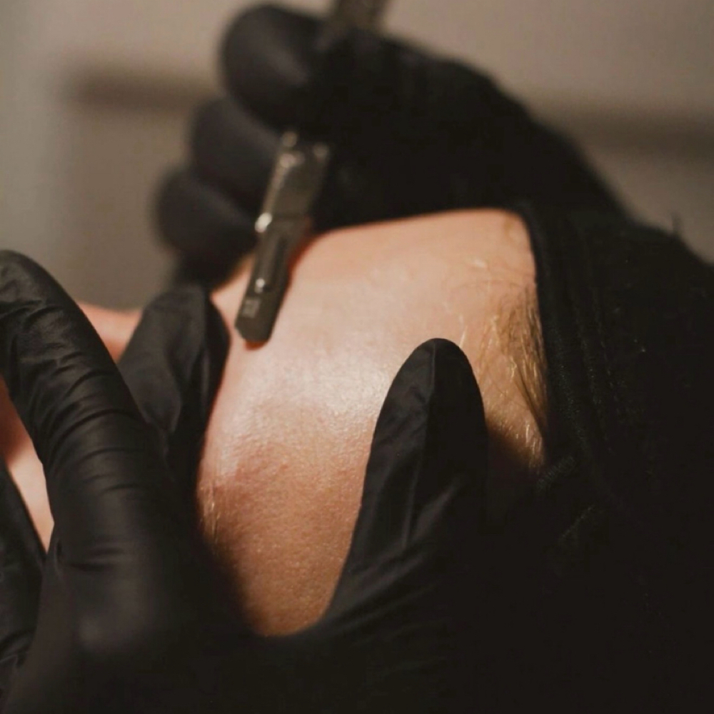 Dermaplane Only at Graceful Effects Day Spa in Brandon, MS