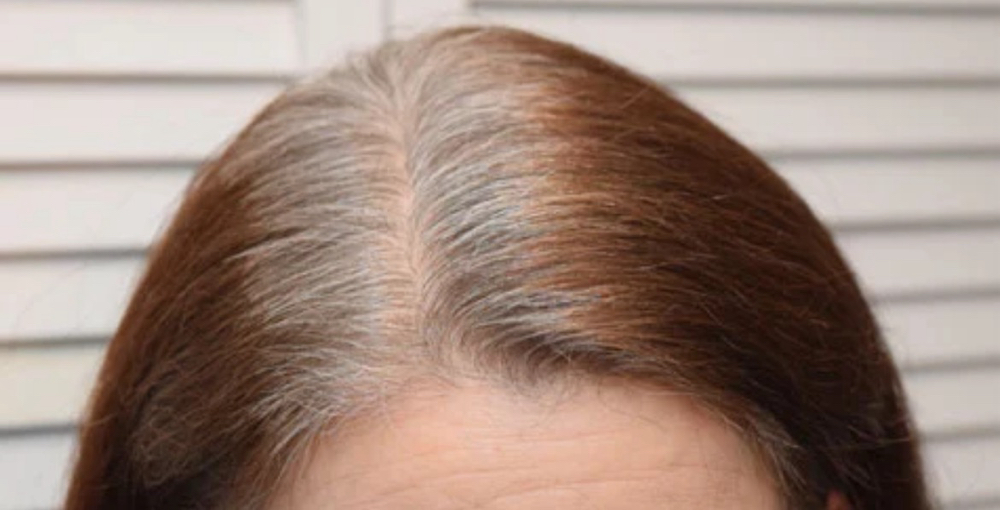 Root Touchup