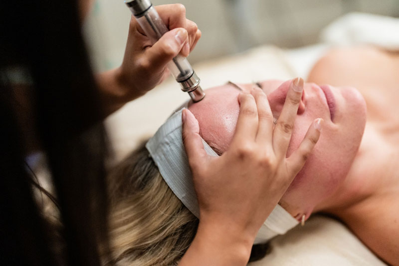 Microdermabrasion Facial