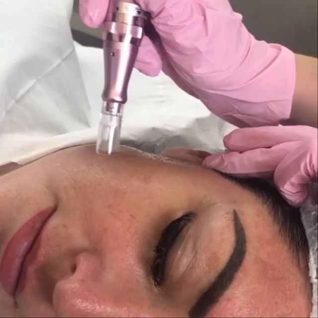 Microneedling Renewal Ritual at Xo Nail Salon in Watseka, IL
