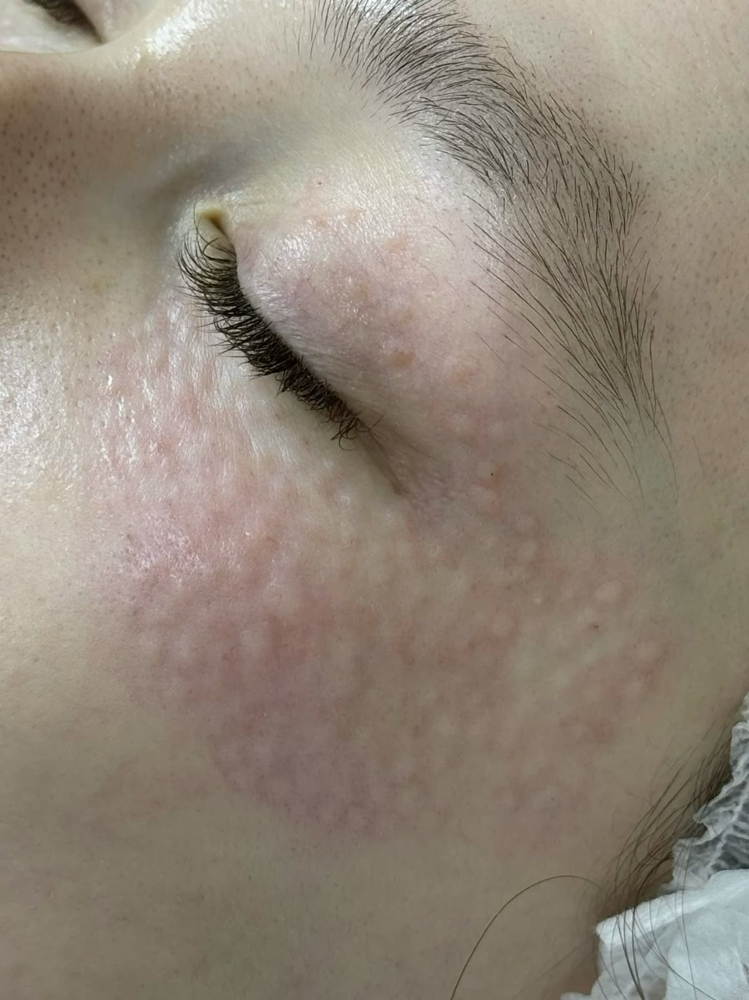 Salmon Boost Glow at Zoraya Velez AESTHETICIAN in Richmond, VA