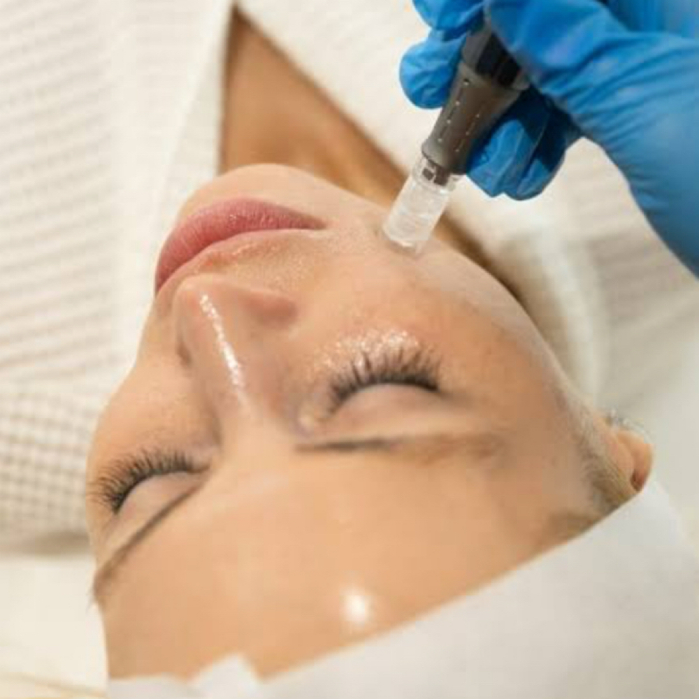 Nano-infusion Therapy at ENV Beauty Bar in Ontario, CA