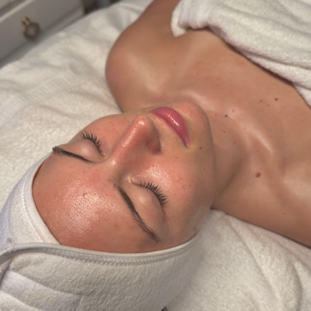 Hydrodermabrasion Facial at TLC Esthetics in Winthrop, MA