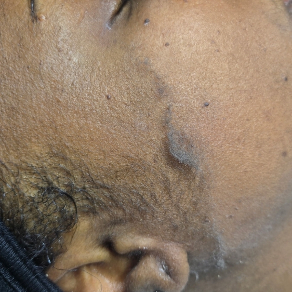 Dermaplaning Facial at Basic and Beyond Brows in Lakewood, CA