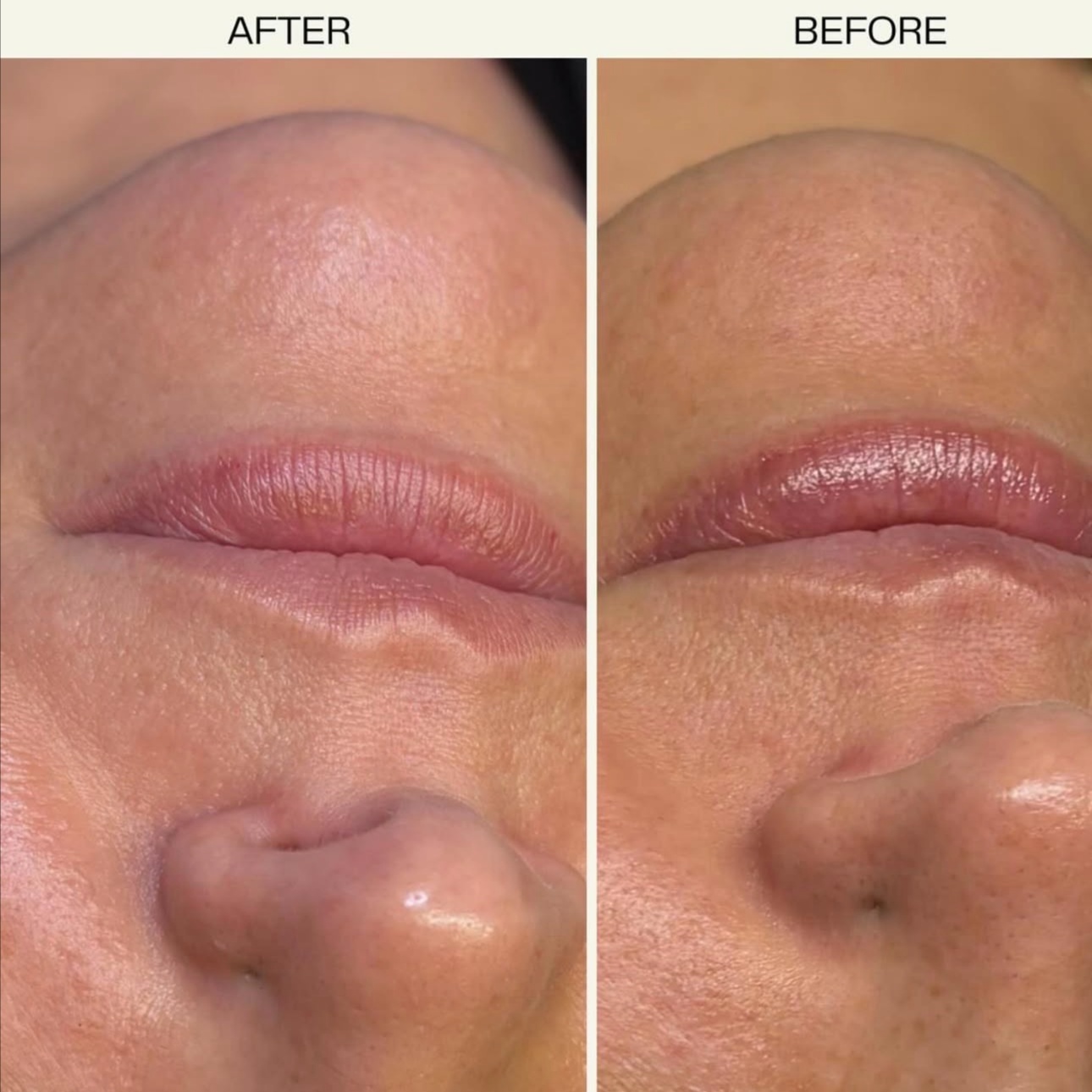 Chem Peel at Piper K Skin Care in Peoria, IL