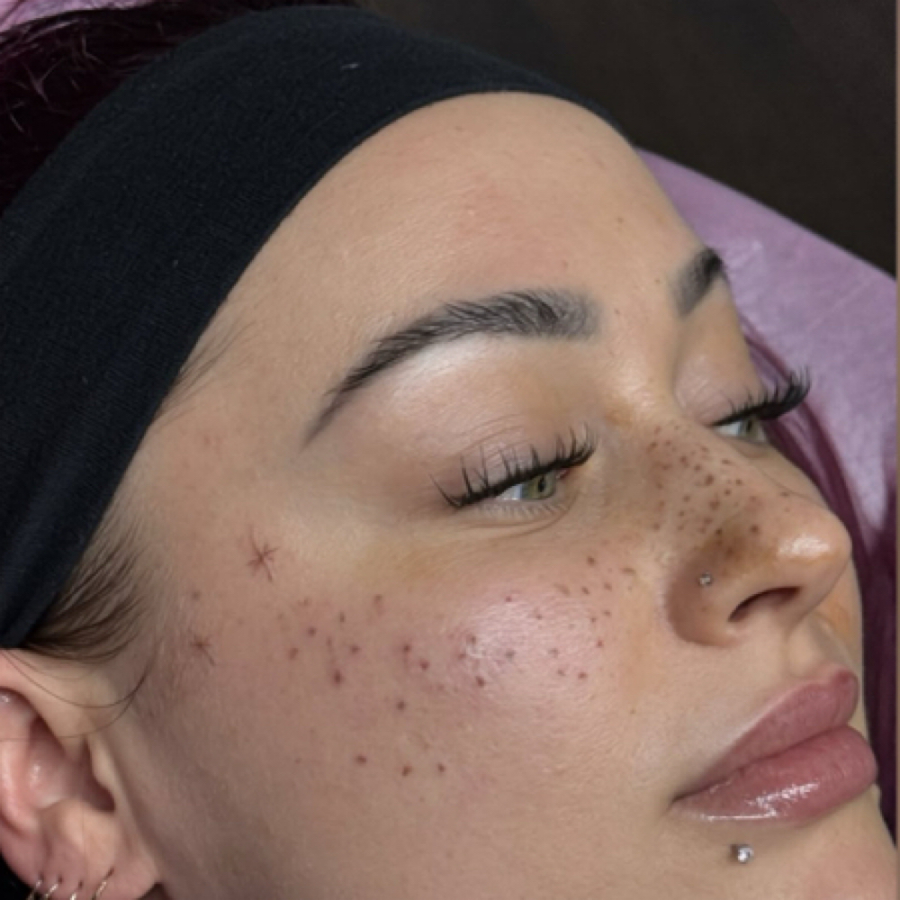 Beauty Marks/Freckle Accent at Inked Beauty by Tyler Rose in Shirley, NY
