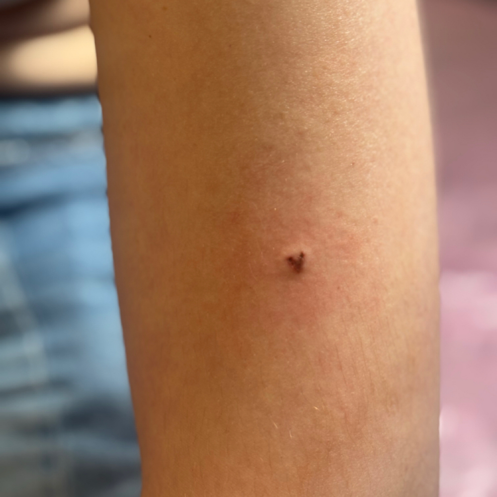 Beauty Marks/Freckle Accent at Inked Beauty by Tyler Rose in St James, NY