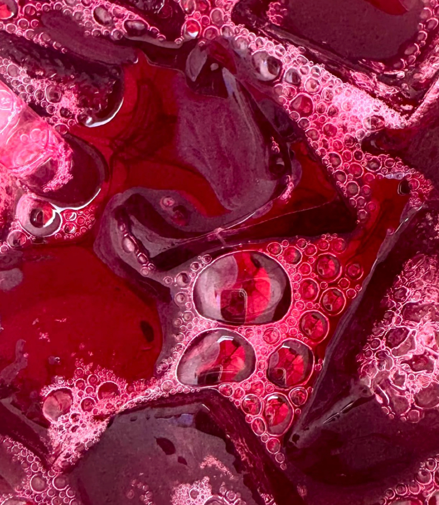 SkinPen Microneedling at Italy Marie Aesthetics in Dallas, TX