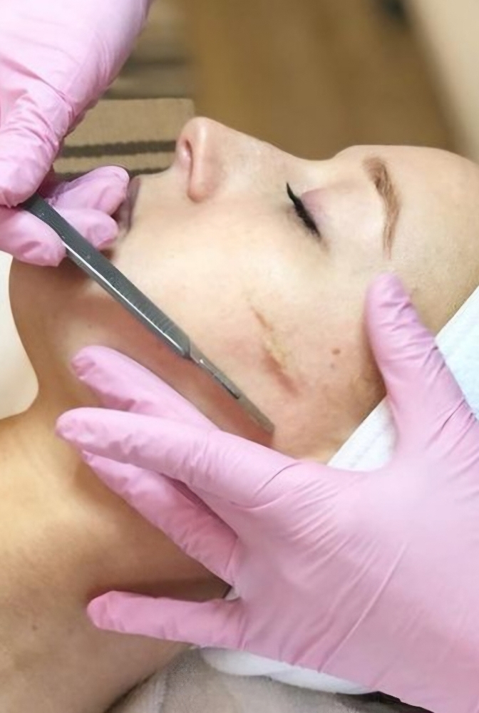 Dermaplane Facial