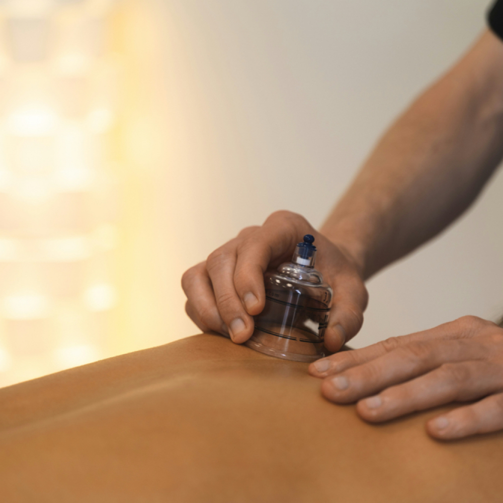 Chinese Cupping Therapy at The Whole You Spa in Bronx, NY