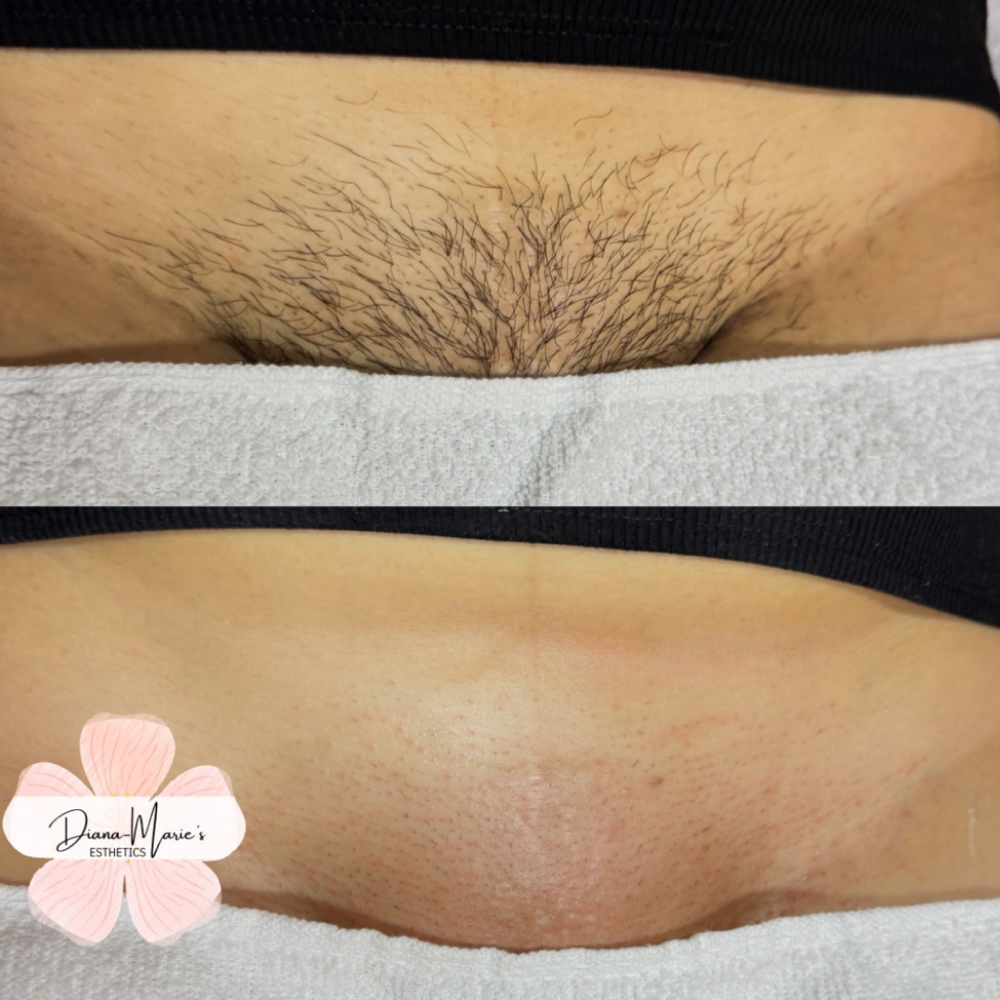 Brazilian Wax  Services