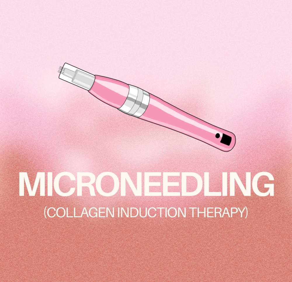 Microneedling