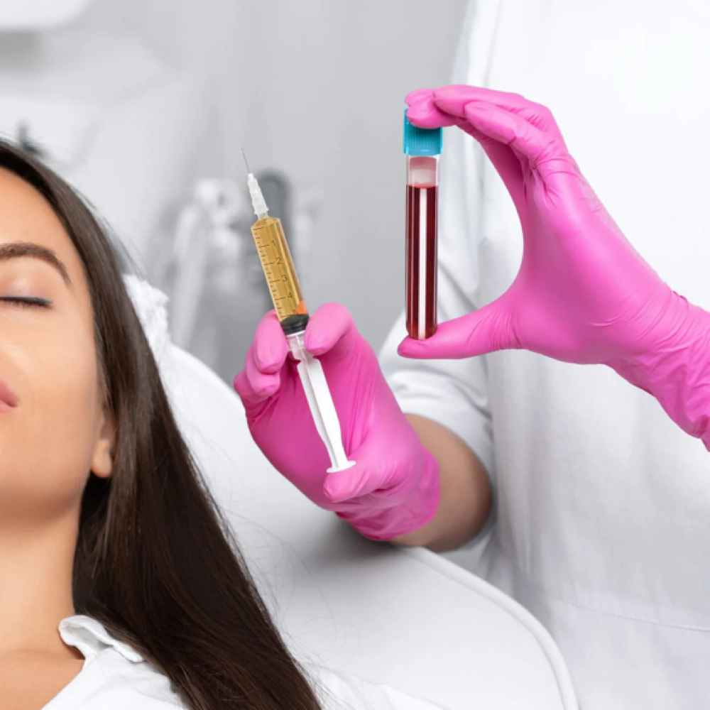 PRF Dark Circle Correction at The SkinLab Aesthetics in Houston, TX