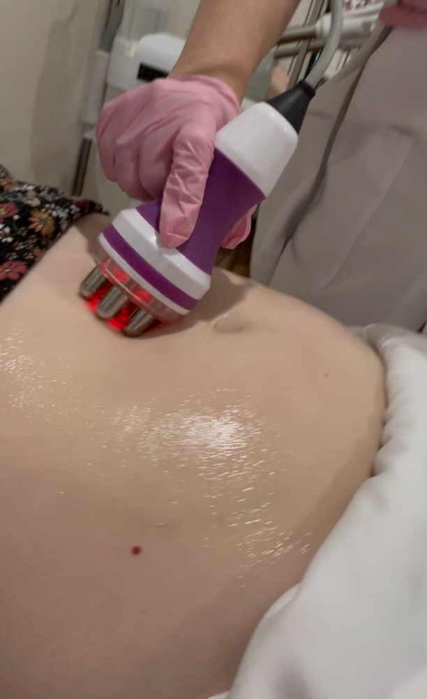 Ultrasonic Fat Reduction