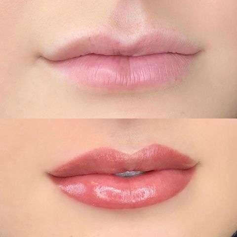 Lip/liner Pigmentation Correction