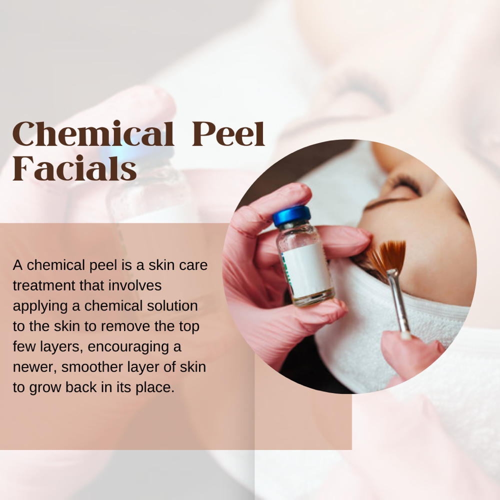 Chemical Peel Facials