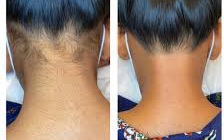Neck