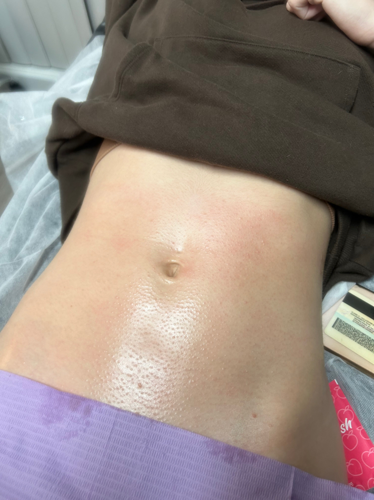 Stomach