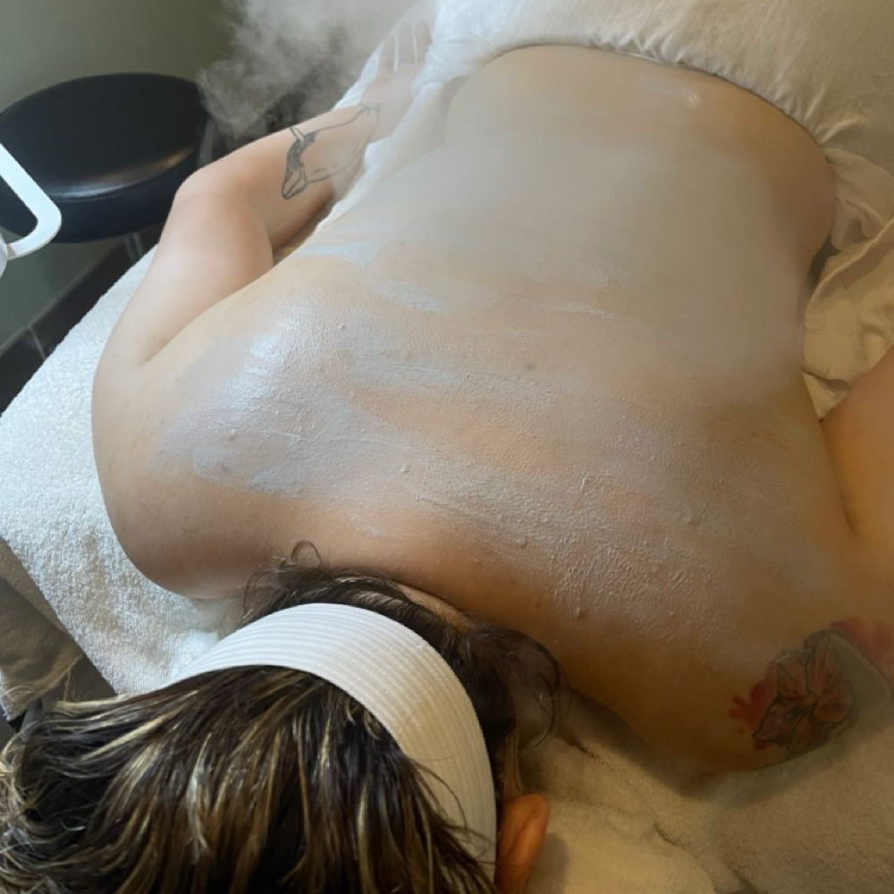 Back Facial at Skin Theory-Katie in Perry, FL