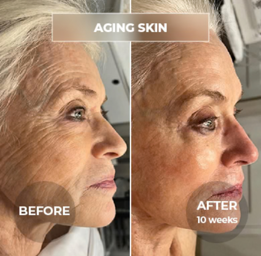 SWiCH Treatment Facial