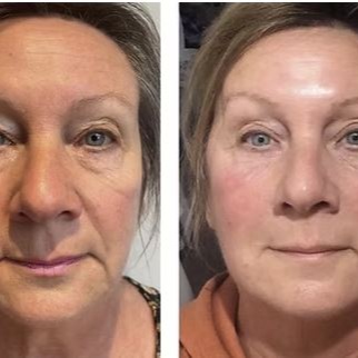 Anti-Aging Facial at Tiffany - Sculpted Beauty in Nettleton, MS