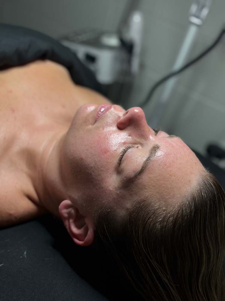 Oxygen Facial