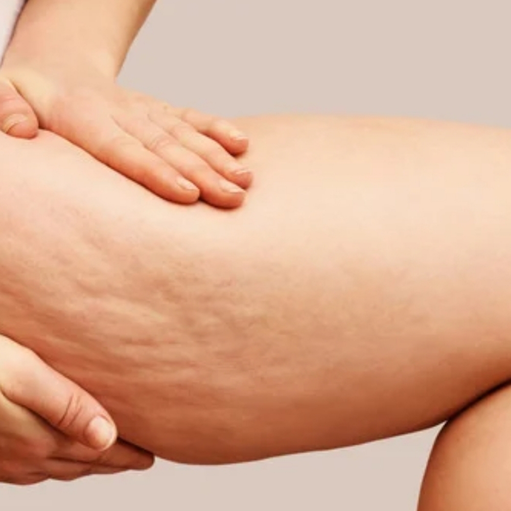 Cellulite & Texture Therapy
