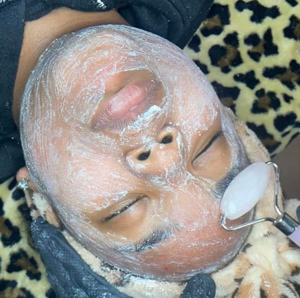 Microdermabrasion Treatment