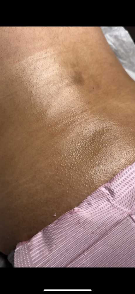 Back Wax