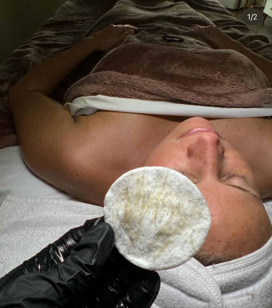 Dermaplaning Facial