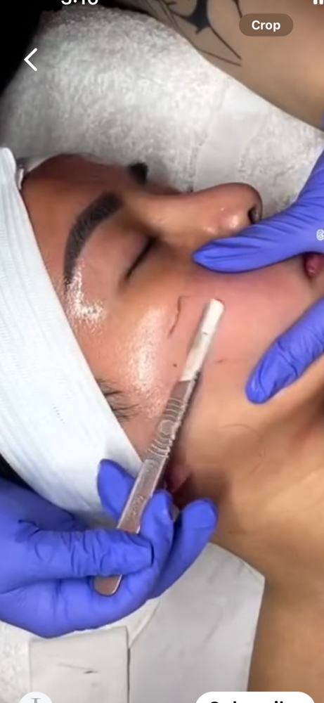 Dermaplane Facial