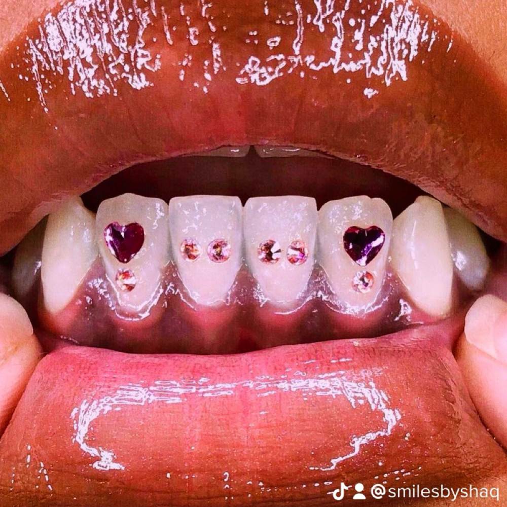 Custom Design (Gems) at Shaqs Teeth Whitening in Tarboro, NC