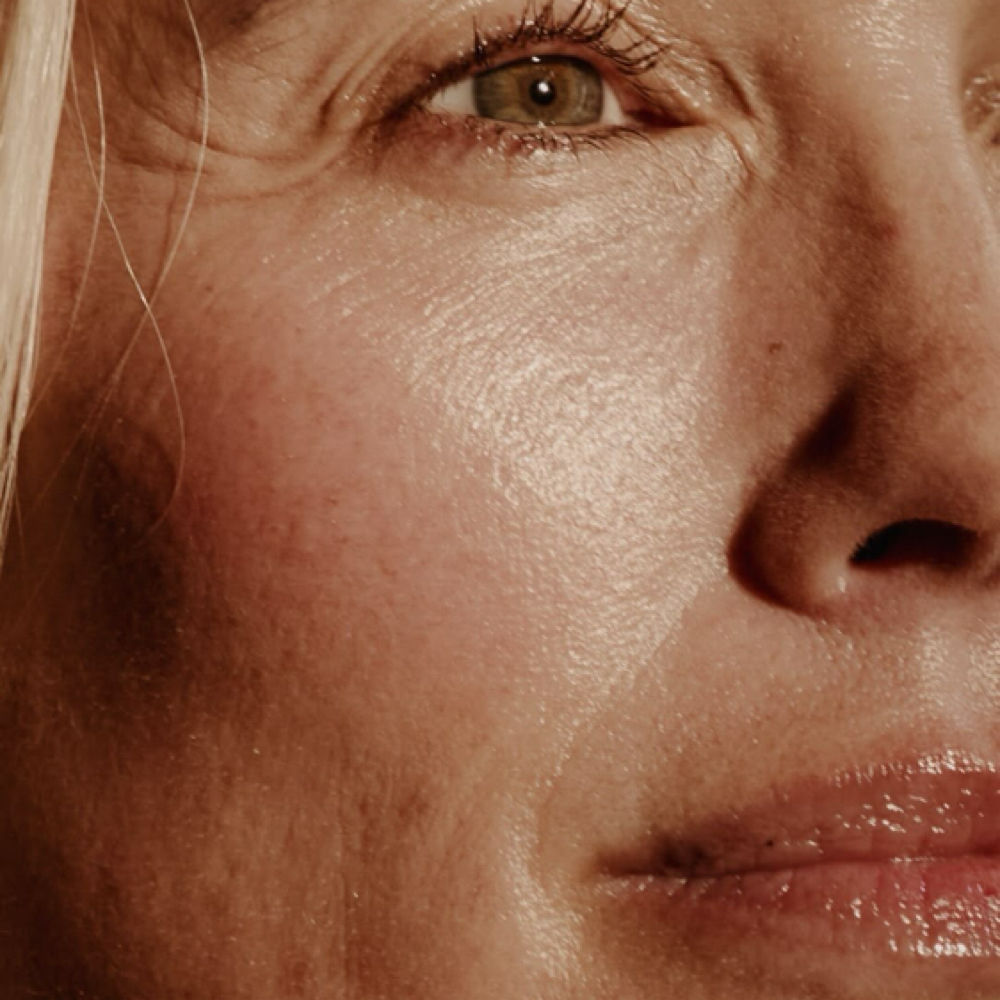 Anti-Aging Facial at Wildflower Wellness | Esthetics & Massage in Jackson, TN