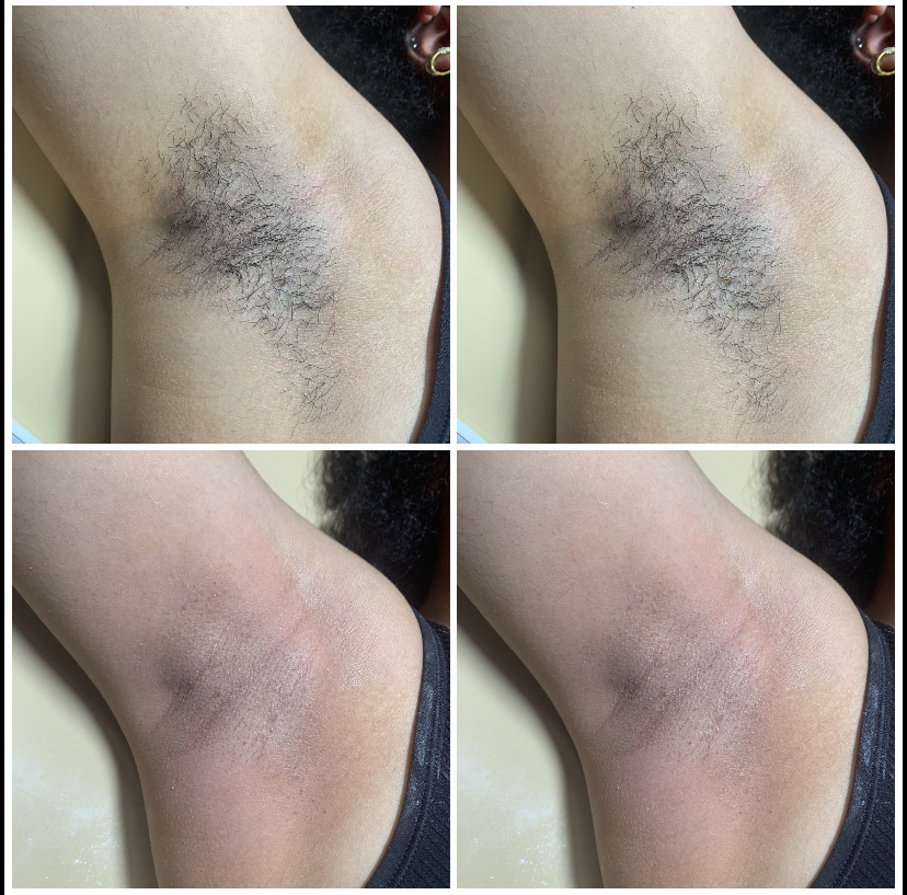 Underarm Wax