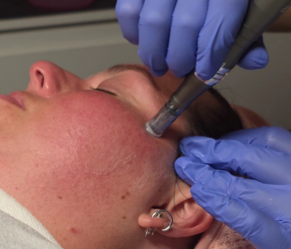 Nano Infusion Facial Add On