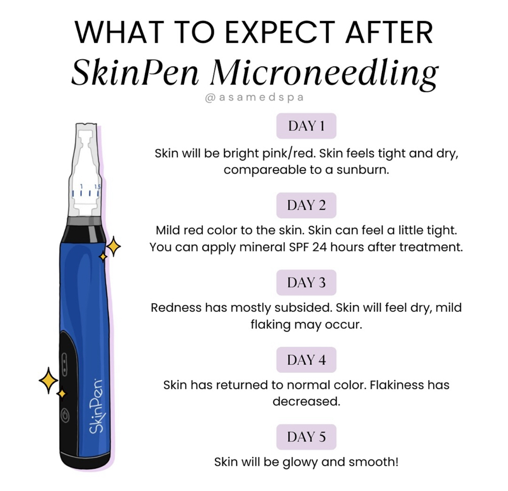 MICRONEEDLING + PEPTIDES PLASMA LED