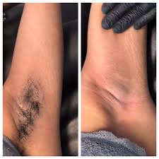 Underarm Wax