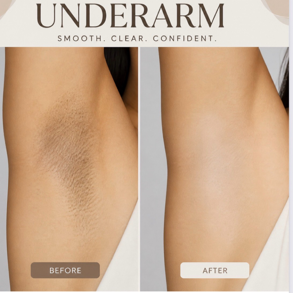 Underarm Wax at CYT Beauty Collective in Marietta, GA