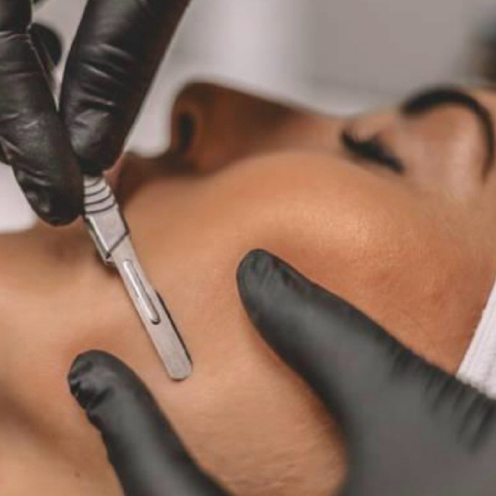Dermaplane Facial at Beauty By Keri in Franklin, MA