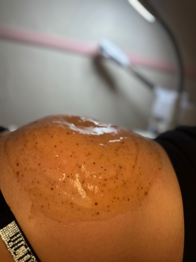 Belly Bump Treatment