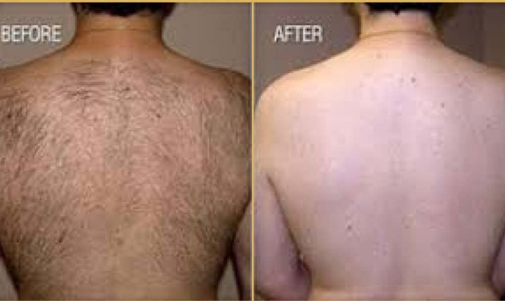 Back Wax (Normal/medium Hair)