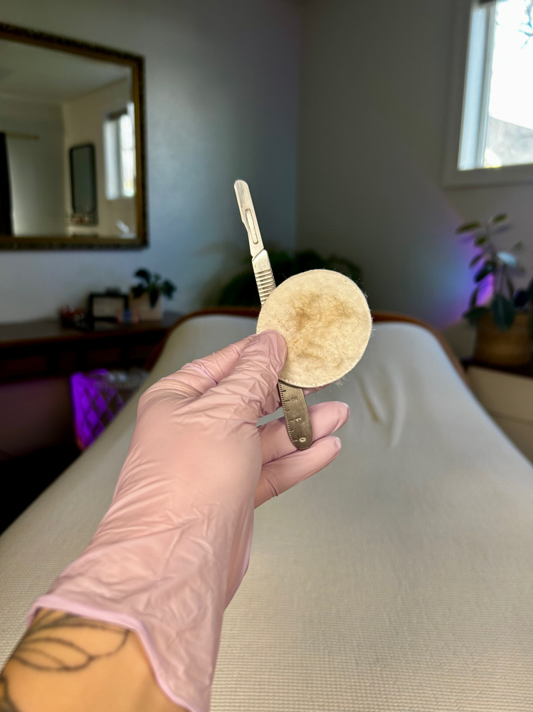 Dermaplane