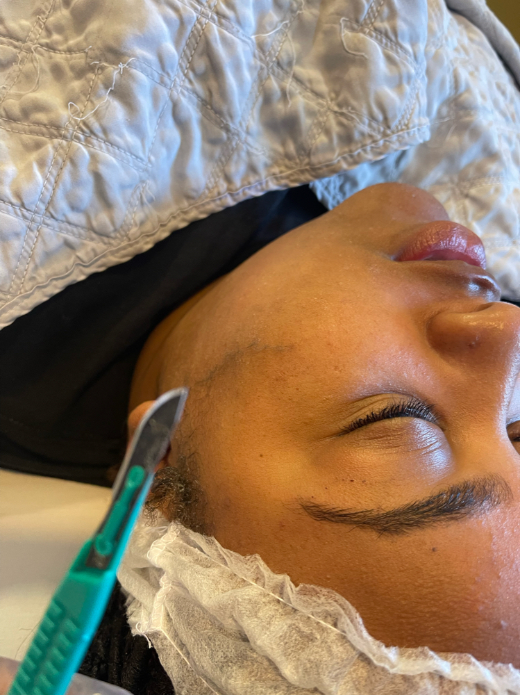 Dermaplaning at Mo3 Beauty Studio in Vestavia Hills, AL